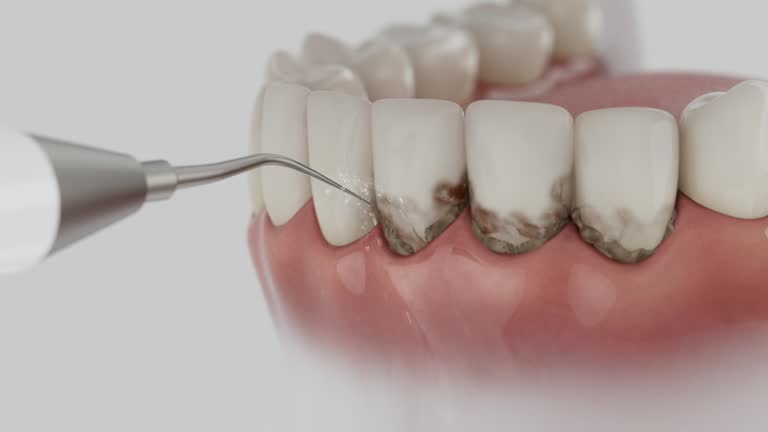 Reliable Dental Implants contractor in Kentfield, CA by Smile Center Dentistry
